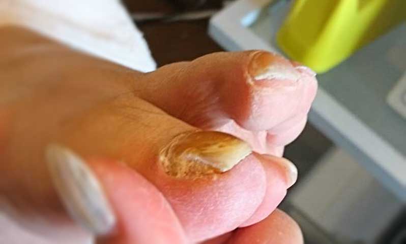 諦めたくない足のトラブル